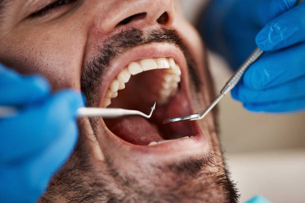 Best Emergency Dental Care for Broken or Chipped Teeth in Lake Como, NJ
